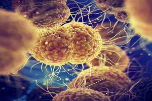 ​Arrestimi i Millosh Steviq, Prokuroria Themelore jep detaje